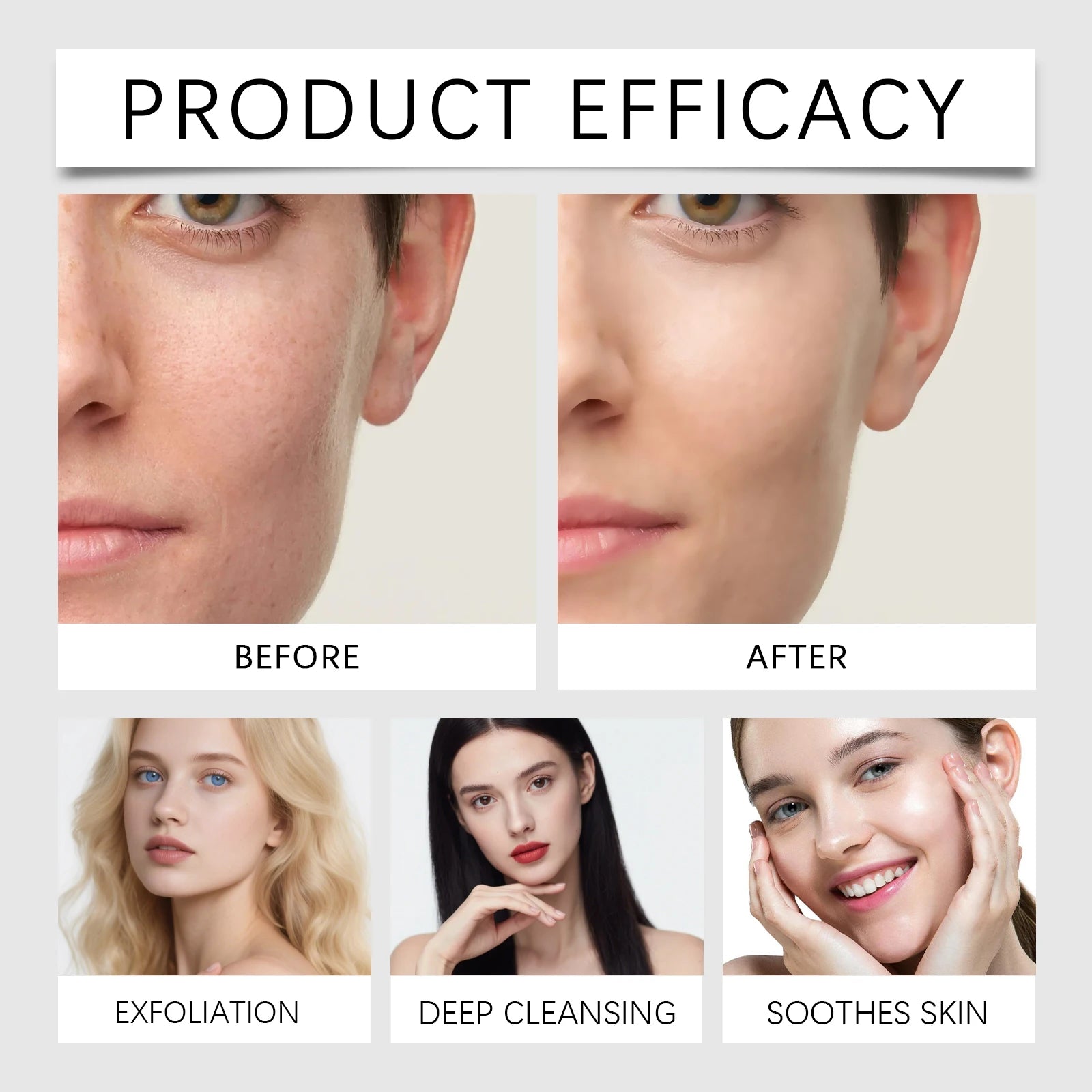 Korean Exfoliating Facial Cleansing Pores Remove Dead Skin Purify