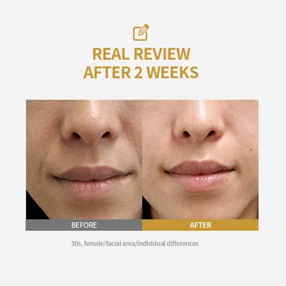 Peptide Intensive Lifting Ampoule Deep Collagen Face Firming Moisturizing